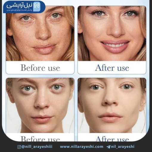 سرم صورت آبرسان هیالورونیک اسید سادور 100 میل ( بدون جعبه )